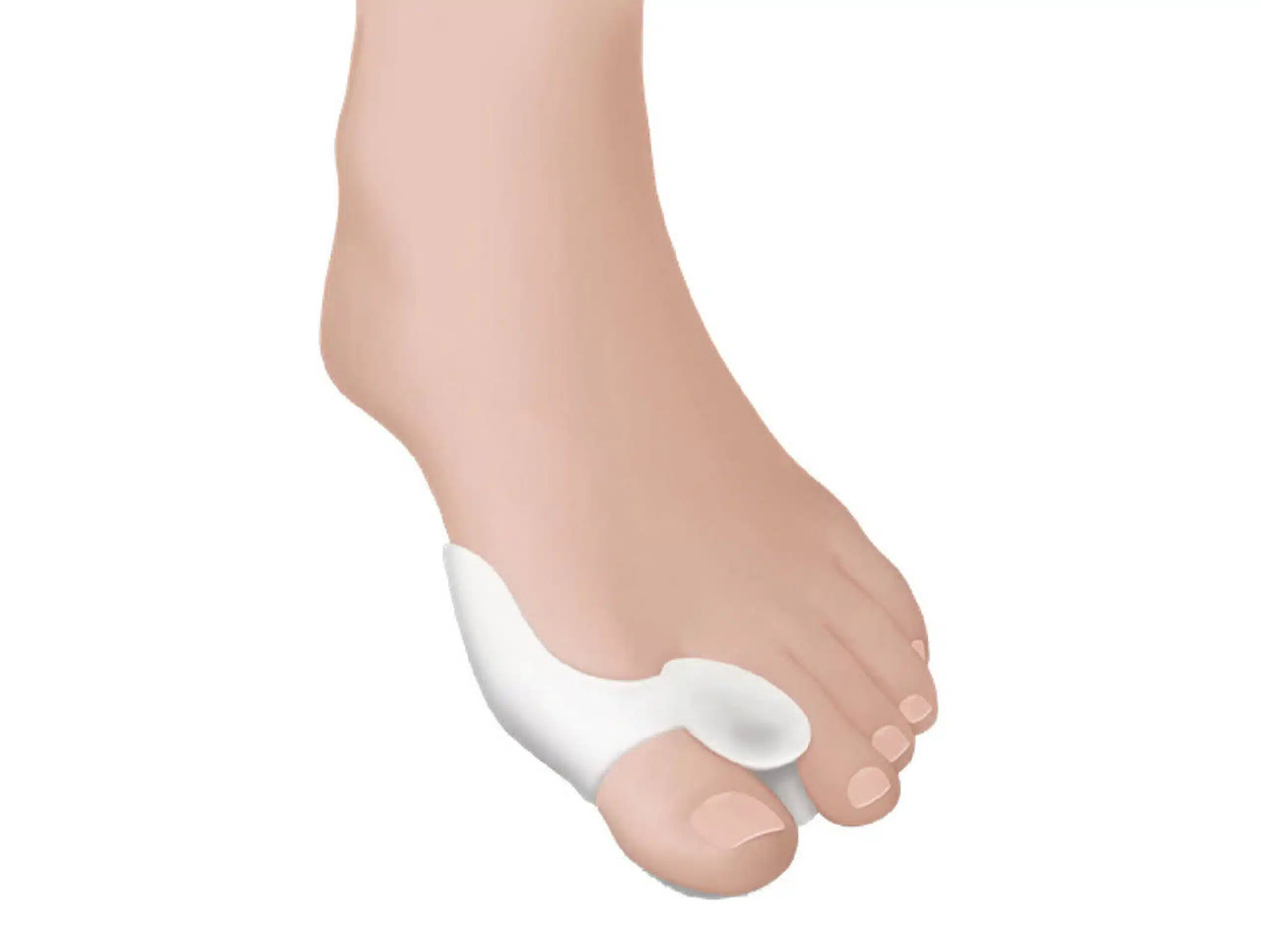 CASE SOFT STEP PROTECTEUR HALLUX VALGUS REF SS032