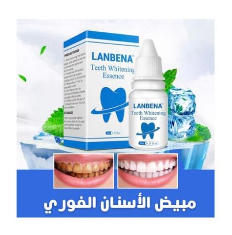 مبيض الاسنان الفوري