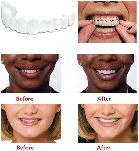 مقوم الاسنان