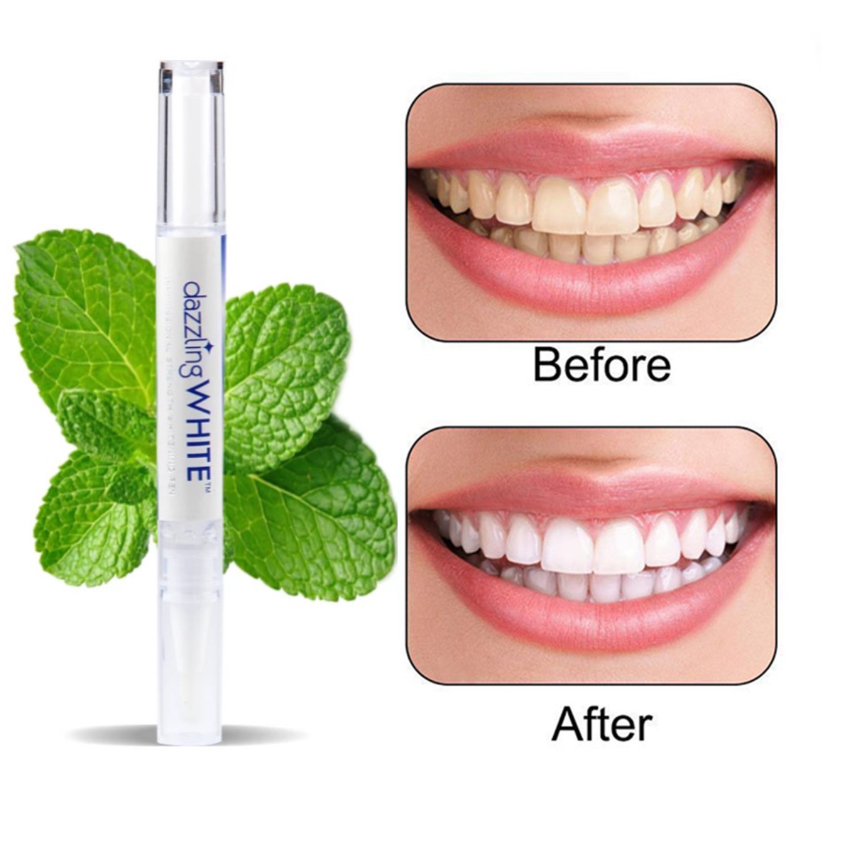 قلم جل لتبيض الاسنان