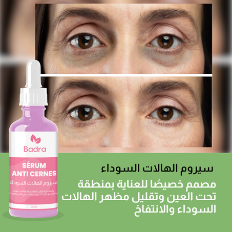 سيروم الهالات السوداء منطقة تحت العين