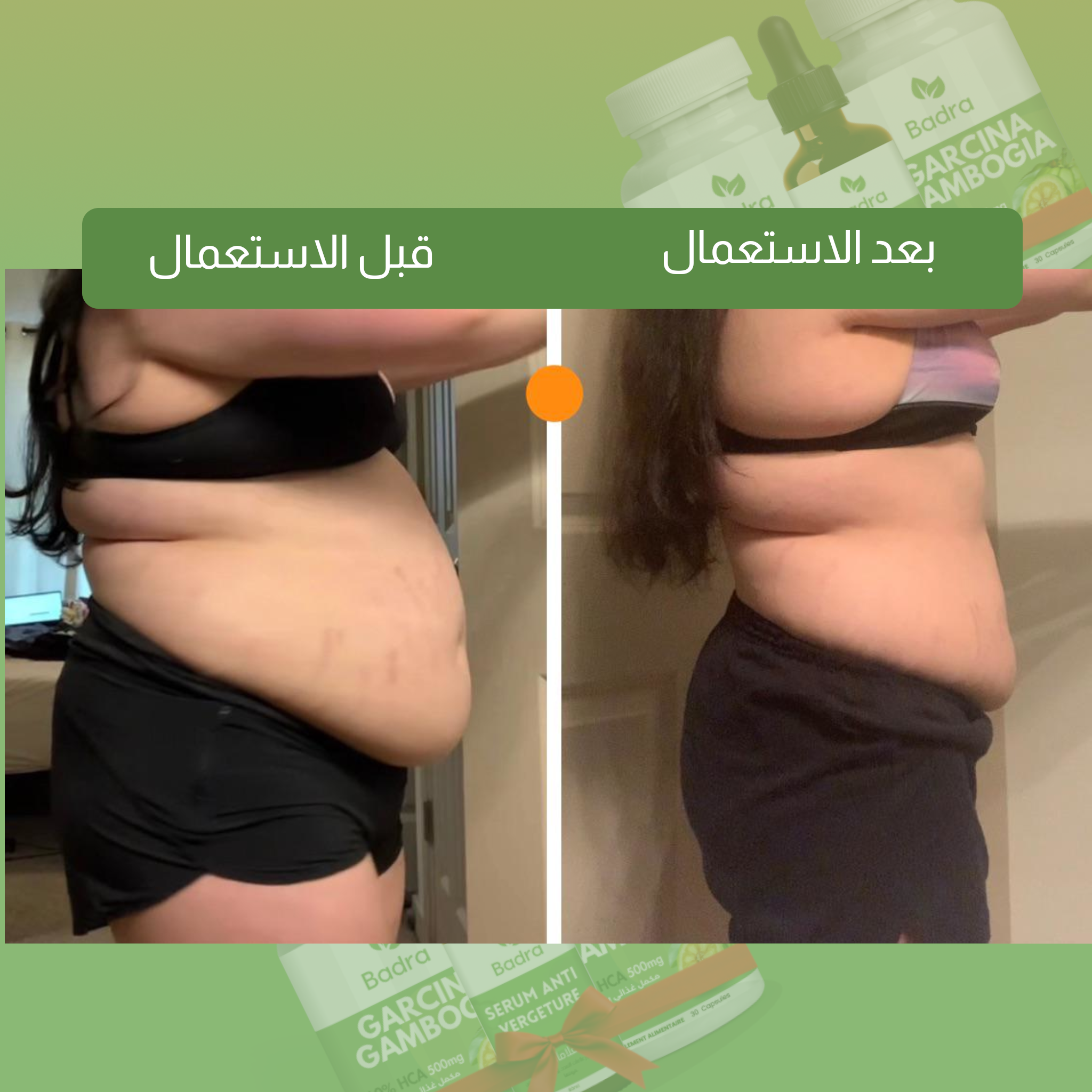 باقة خسارة الوزن + سيروم علاج تمدد الجلد