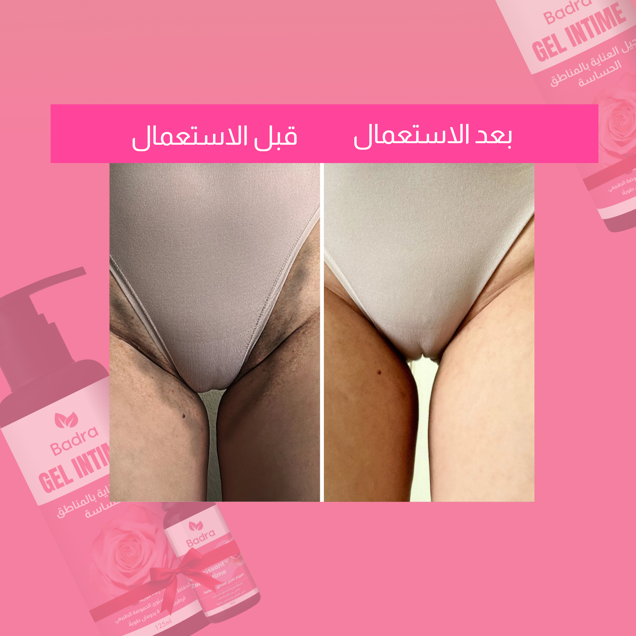 باقة تبيض و العناية بالمناطق الحساسة