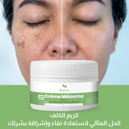 كريم علاج  الكلف و  البقع الداكنة