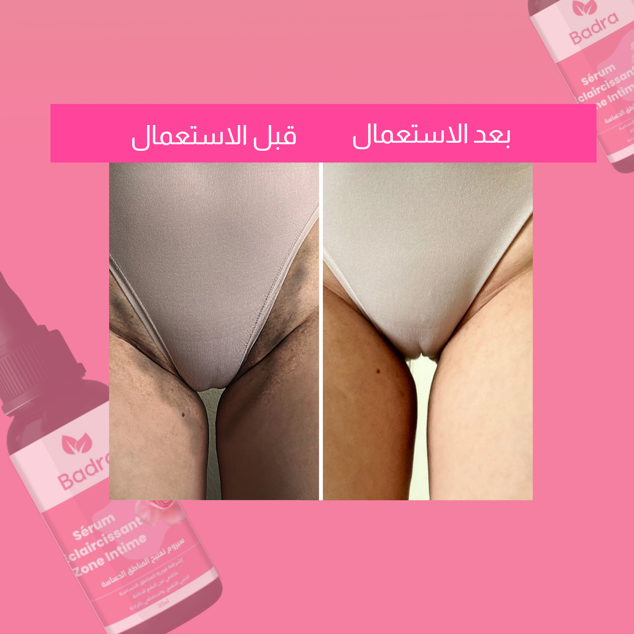 سيروم تبييض المناطق الحساسة