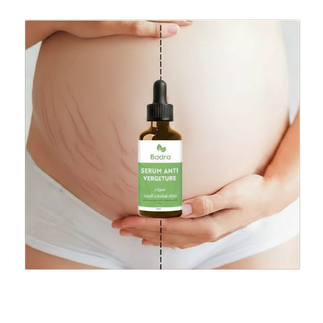 سيروم علاج اثار تمدد الجلد