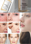 stores/e02d93a69d25c04a2e8d5ecae1046f05/products/tuVYalBj1igeNcdF8I6dewO5KBcMNVPH9JDot7uI.png