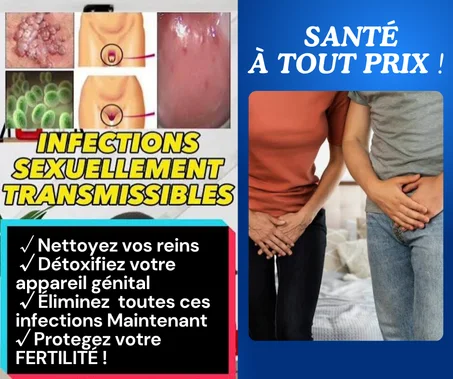 CLAMY STOP 🌿 Puissant traitement naturel contre toutes les IST (Infections Sexuellement Transmissibles) et Nettoyage intime 🧘🏾‍♂️🧘🏼‍♀️ +1 PAQUET DE THÉS SANTÉ DES REINS OFFERT