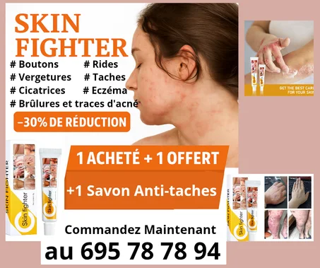 SKIN FIGHTER – Crème Réparatrice Naturelle contre Boutons, Démangeaisons, Cicatrices, Vergetures, Taches et  Brûlures🌿