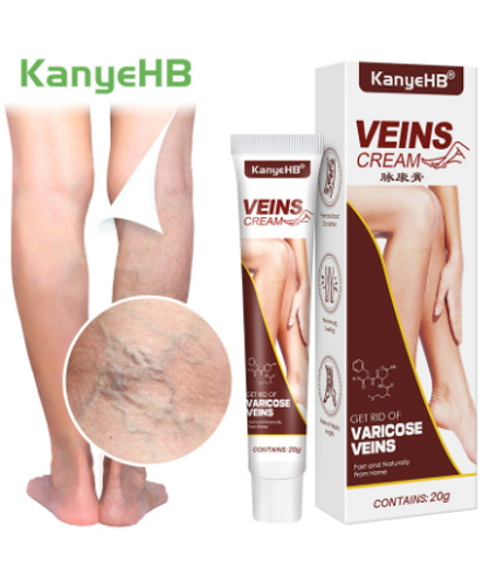 كريم لتخفيف الدوالي