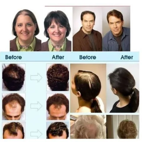 زيت الزنجبيل للشعر