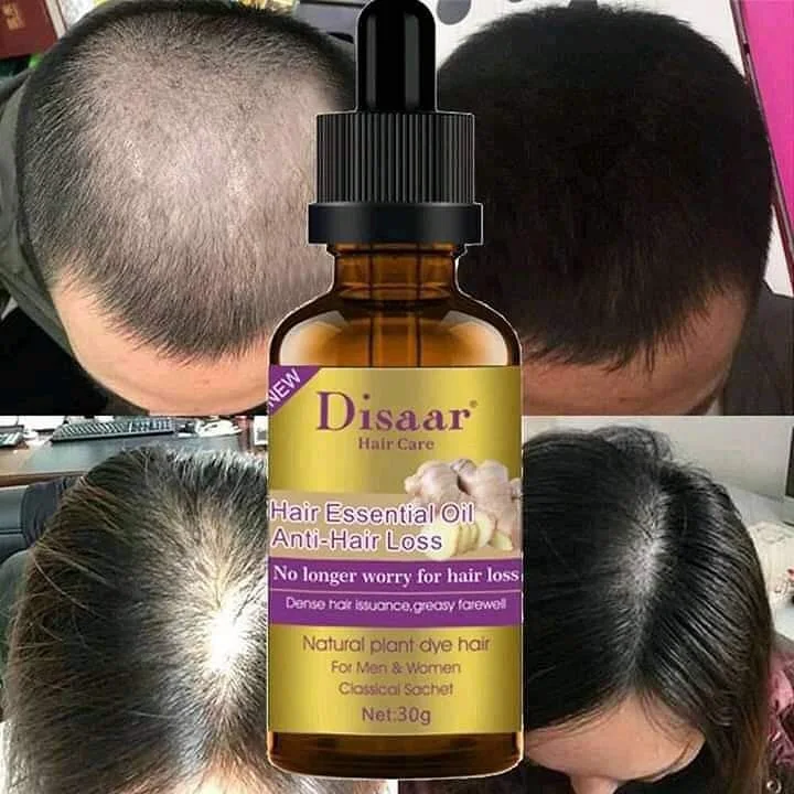 Disaar anti-chute de cheveux - Anti Hair Loss - 😍  زيت يغذي فروة الرأس ويساعد علي نمو الشعر من جذوره  عرض خاص 2 بثمن 1