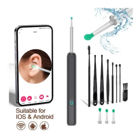 أداة إزالة شمع الأذن الذكية مع العدسة