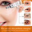 stores/e18bab08d4d371f63bacbc11a85eb662/products/aGvJjQZDuBWv1jVOKLEM054ZFjCWlJkQd1lZDLyn.jpg
