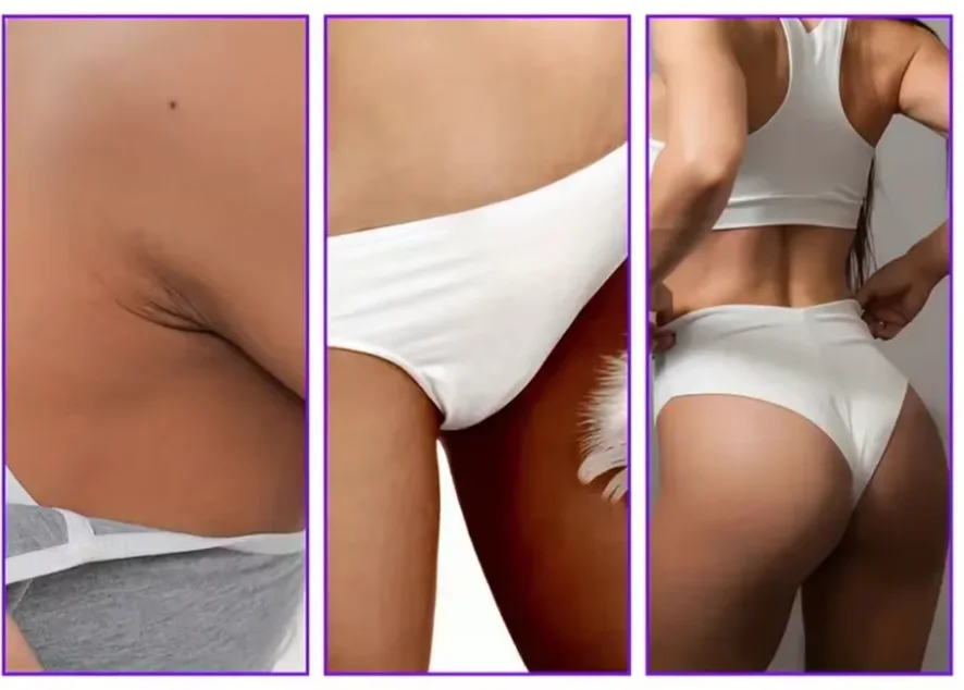 🌸 Malliino – كريم وسيروم لتبيض وتنعيم المناطق الحساسة