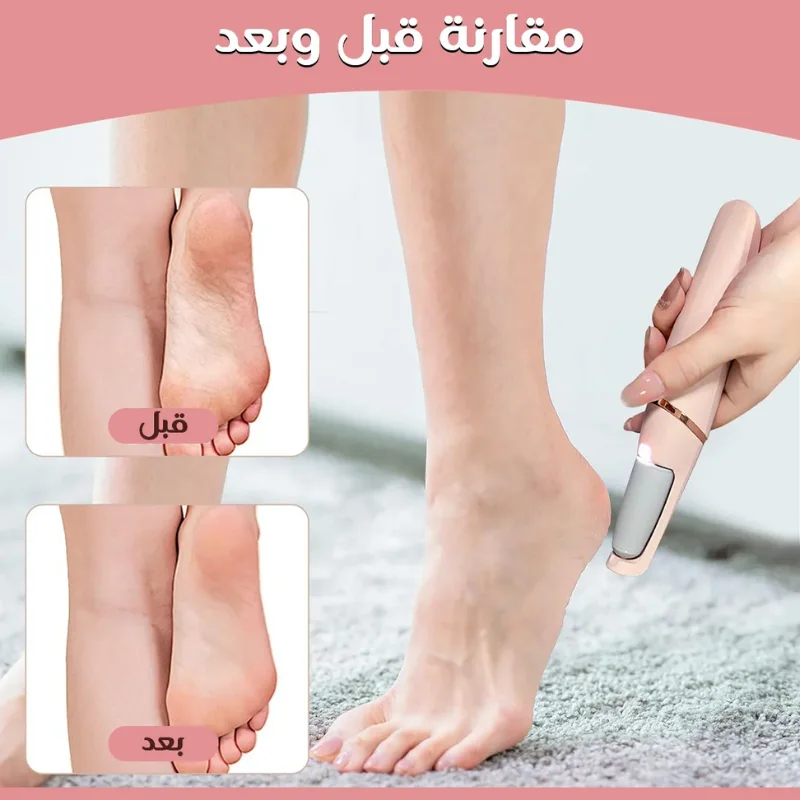 جهاز تنعيم الرجلين 👣