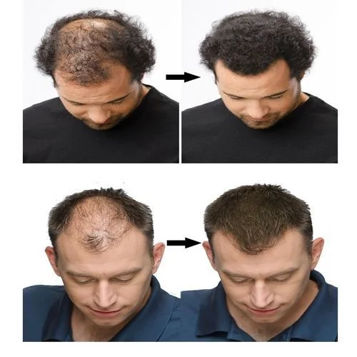 ألياف توبيك لتكثيف الشعر