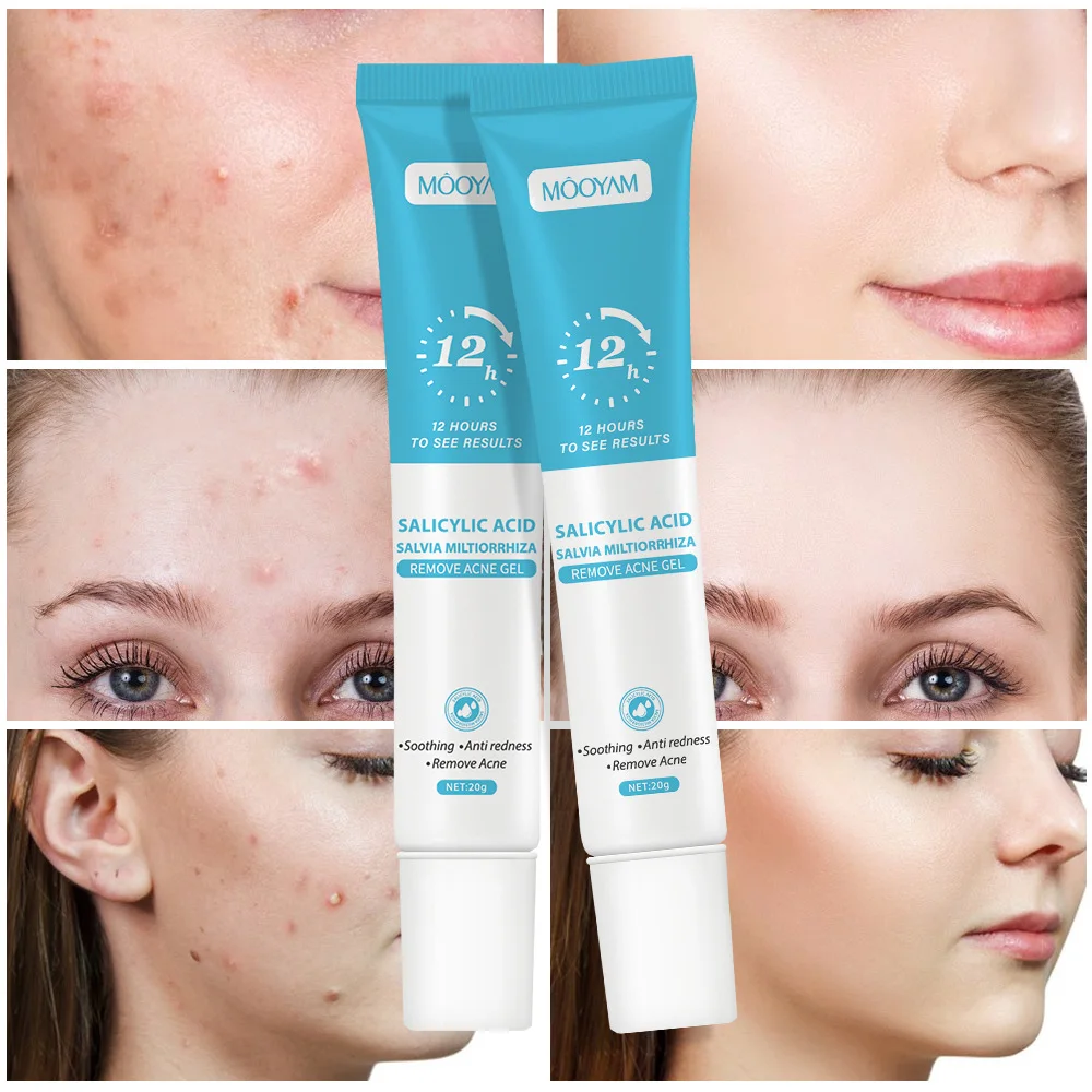 Gel Anti-Acné à l’Acide Salicylique