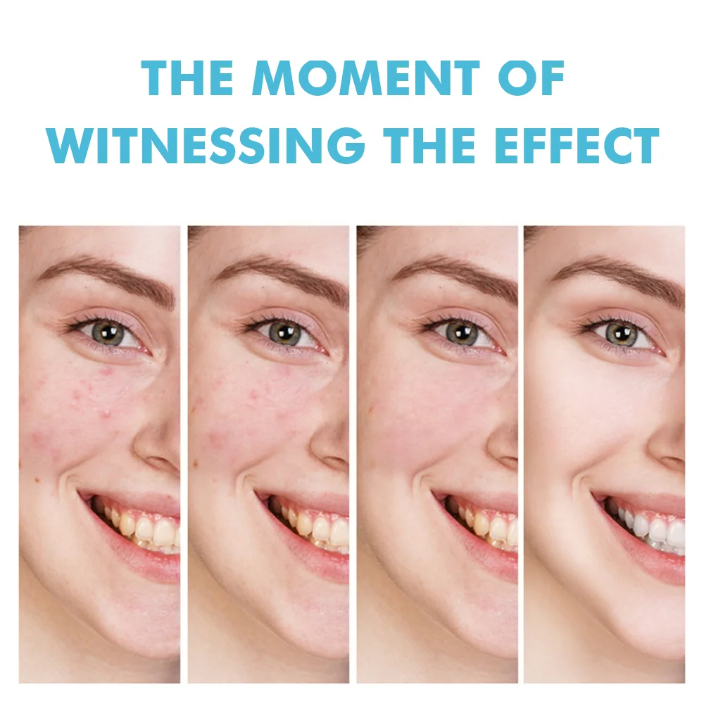 Gel Anti-Acné à l’Acide Salicylique