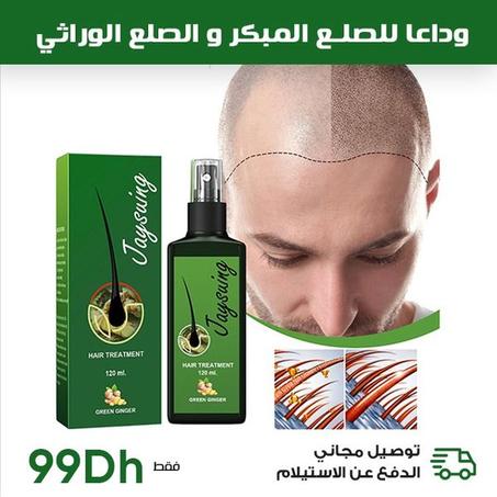 علاج لنمو الشعر