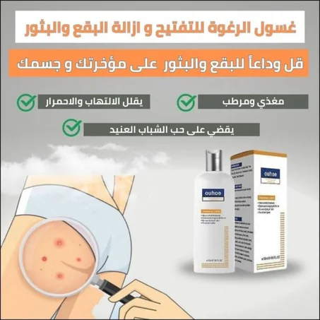 غسول الرغوة للتفتيح و ازالة البقع والبثور Cleansing Lotion