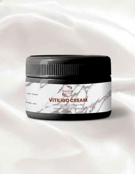 Vitiligo Cream