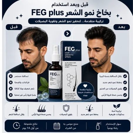 بخاخ نمو الشعر