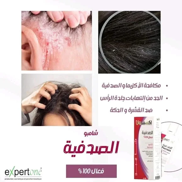 شامبو إكسبيروان الحل الأمثل لعلاج الصدفية و القشرة و الإكزيمة