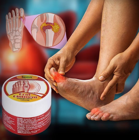 Gout Pain Relief Ointment