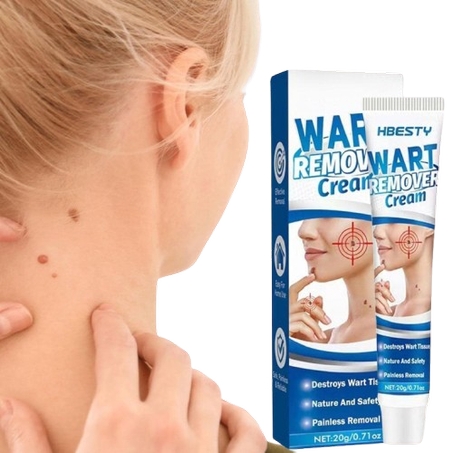 كريم إزالة الثآليل الجلدي