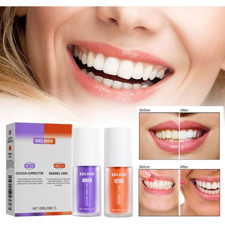 Wholesale Teeth Whitening
