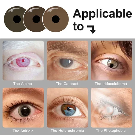 lentilles de contact prosthétique