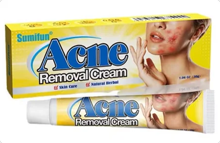 كريم حب الشباب