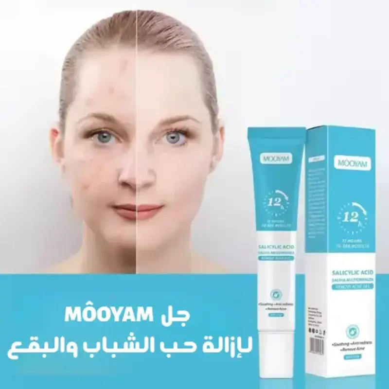 جل MÔOYAM لإزالة حب الشباب والبقع