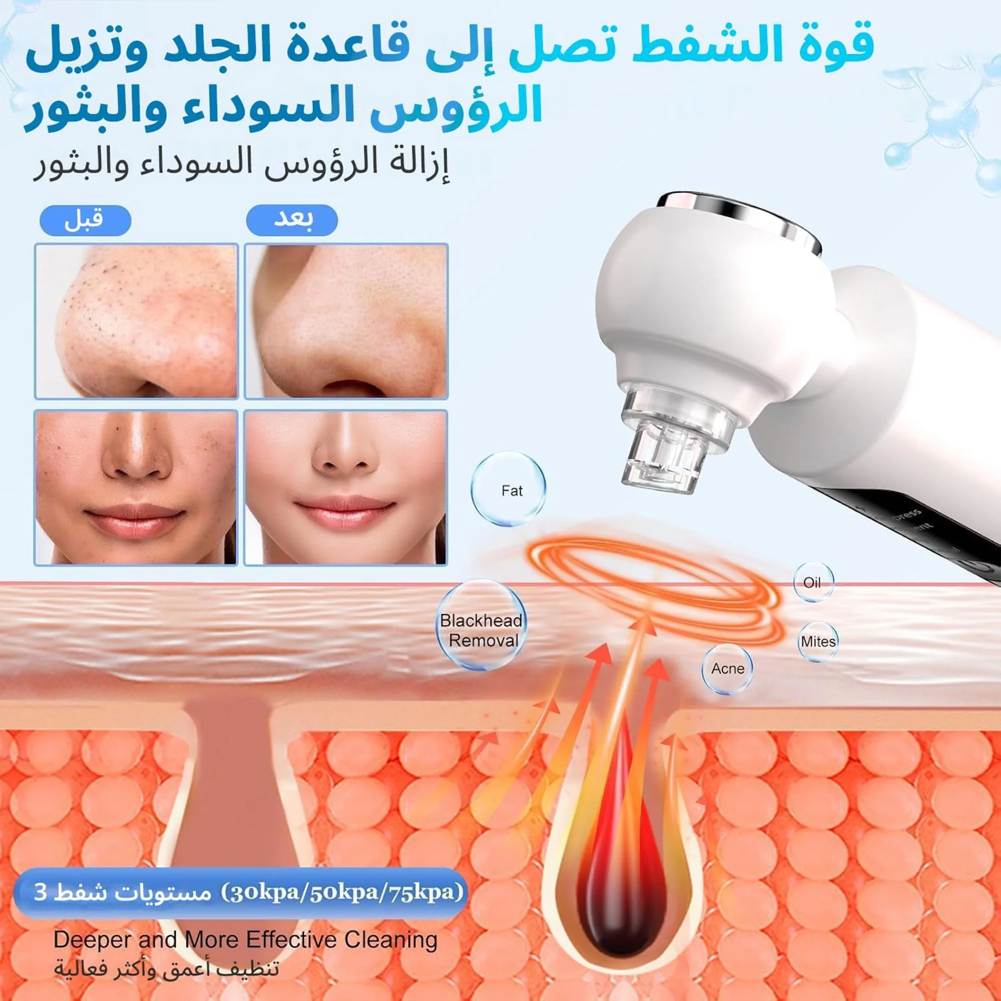 جهاز إزالة الرؤوس السوداء وشفط المسام مع 3 مستويات من الشفط