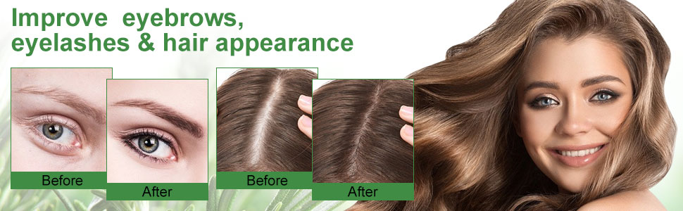 زيت الروزماري الأساسي للعناية بالشعر والبشرة  من Eco Finest 【زيت عطري نقي وطبيعي بنسبة 100%】