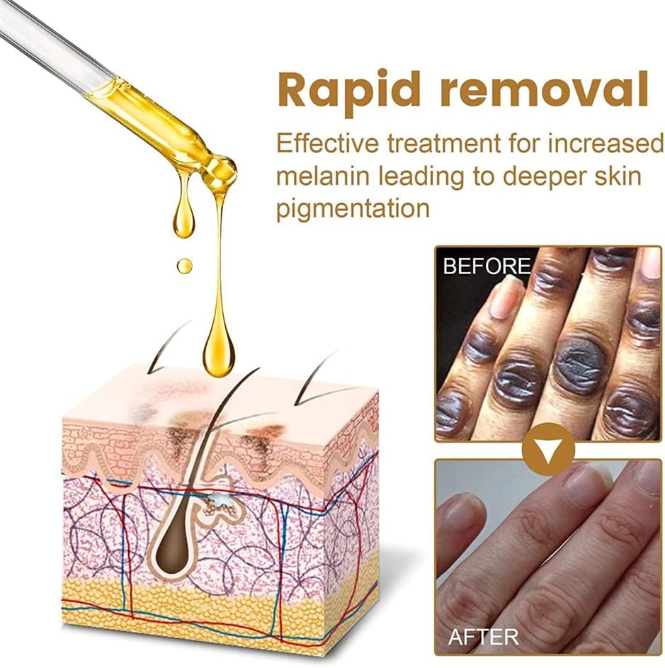 سيروم JAYSUING لعلاج جفاف وتصبغات اليدين – ترطيب عميق ولمسة حريرية