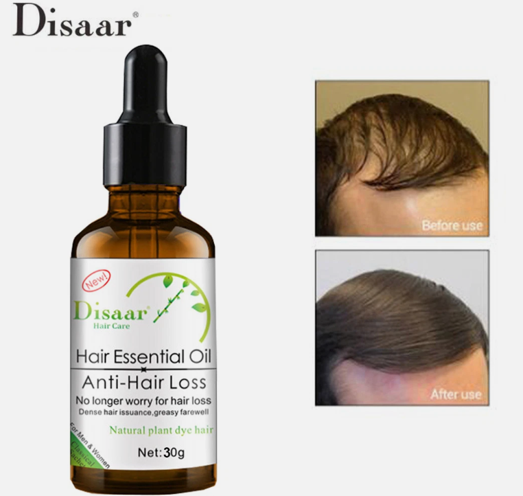 زيت الشعر الأساسي من Disaar – لعلاج تساقط الشعر واستعادة الكثافة الطبيعية (30 جم)