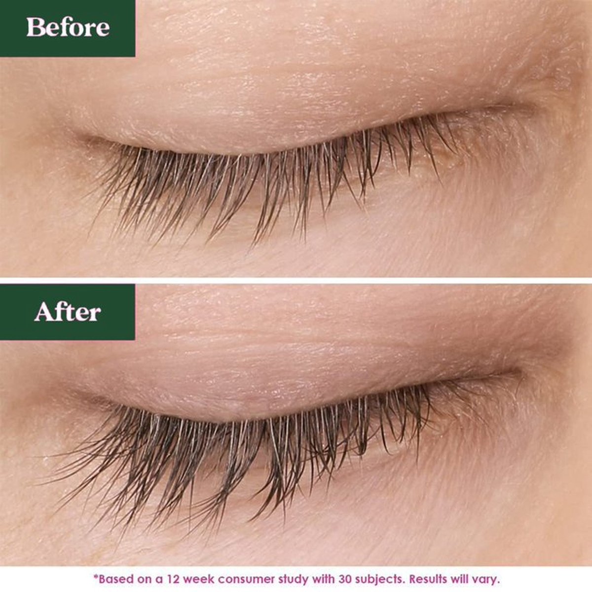 سيروم iBeaLee لتكثيف وتطويل الرموش بشكل طبيعي (8 مل)