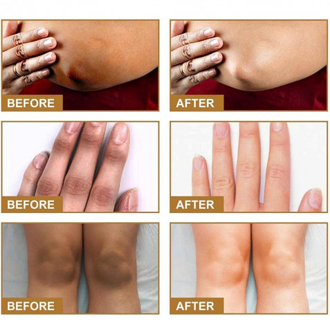 سيروم JAYSUING لعلاج جفاف وتصبغات اليدين – ترطيب عميق ولمسة حريرية