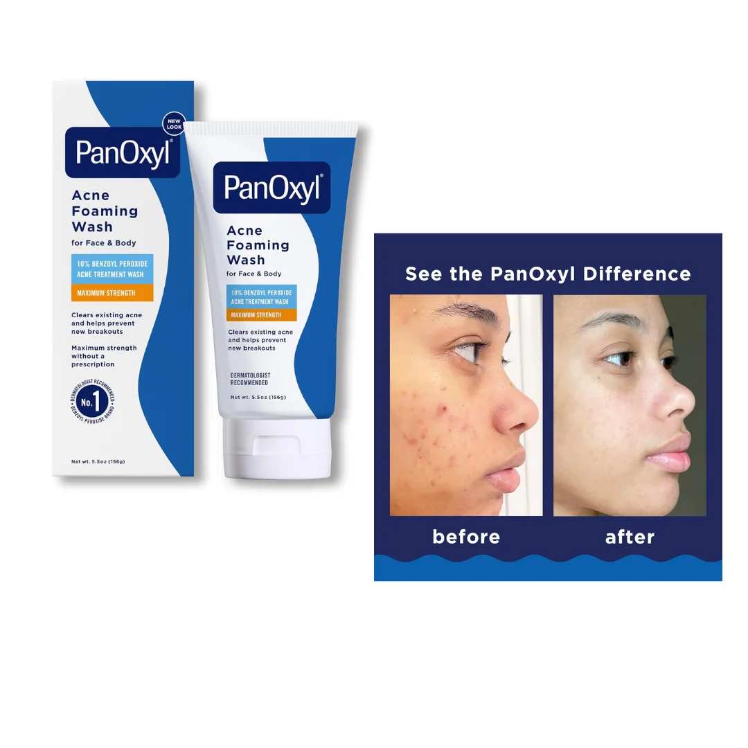 PANOXYL - Nettoyant Moussant contre l'Acné avec 10% de Peroxyde de Benzoyle 156g