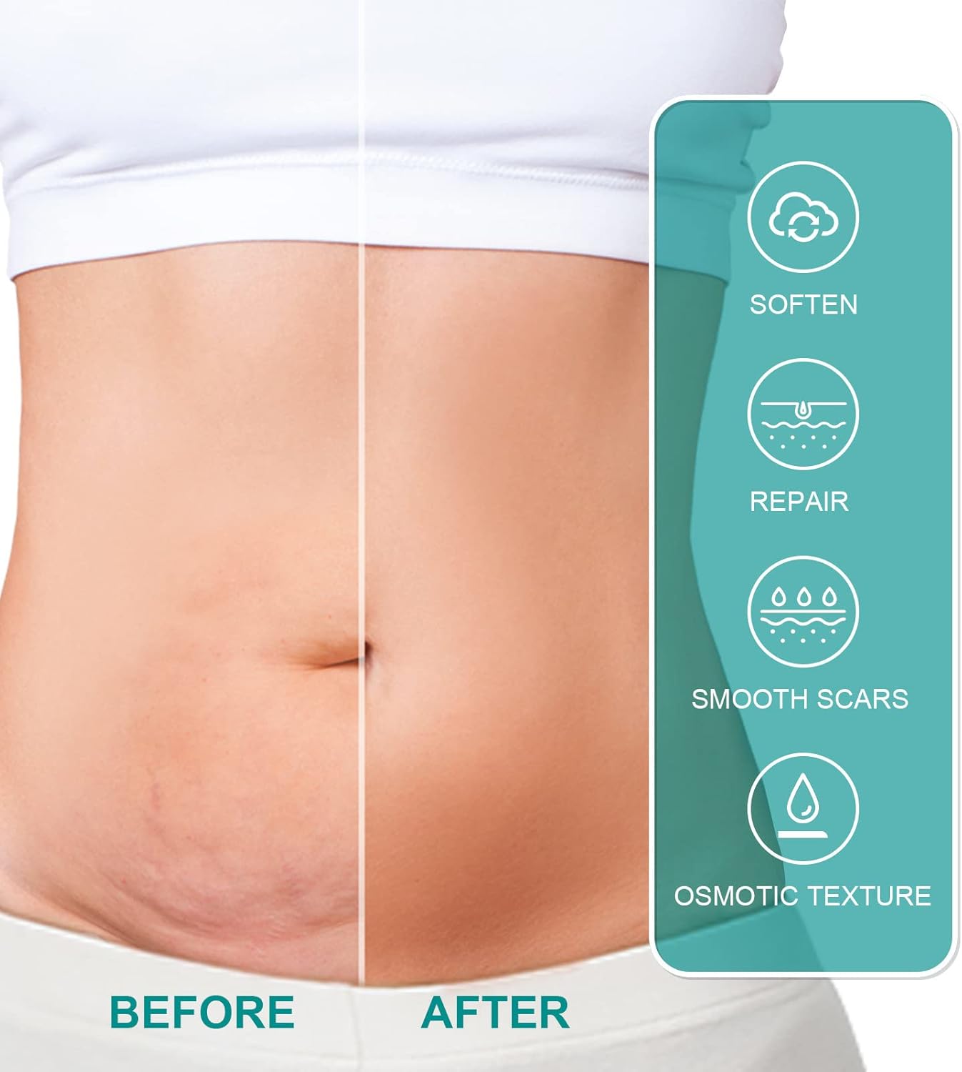 • سبراي طبي لإزالة الندوب