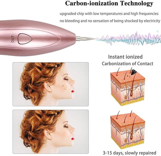 • آلة قلم ليزر لإزالة البقع الداكنة