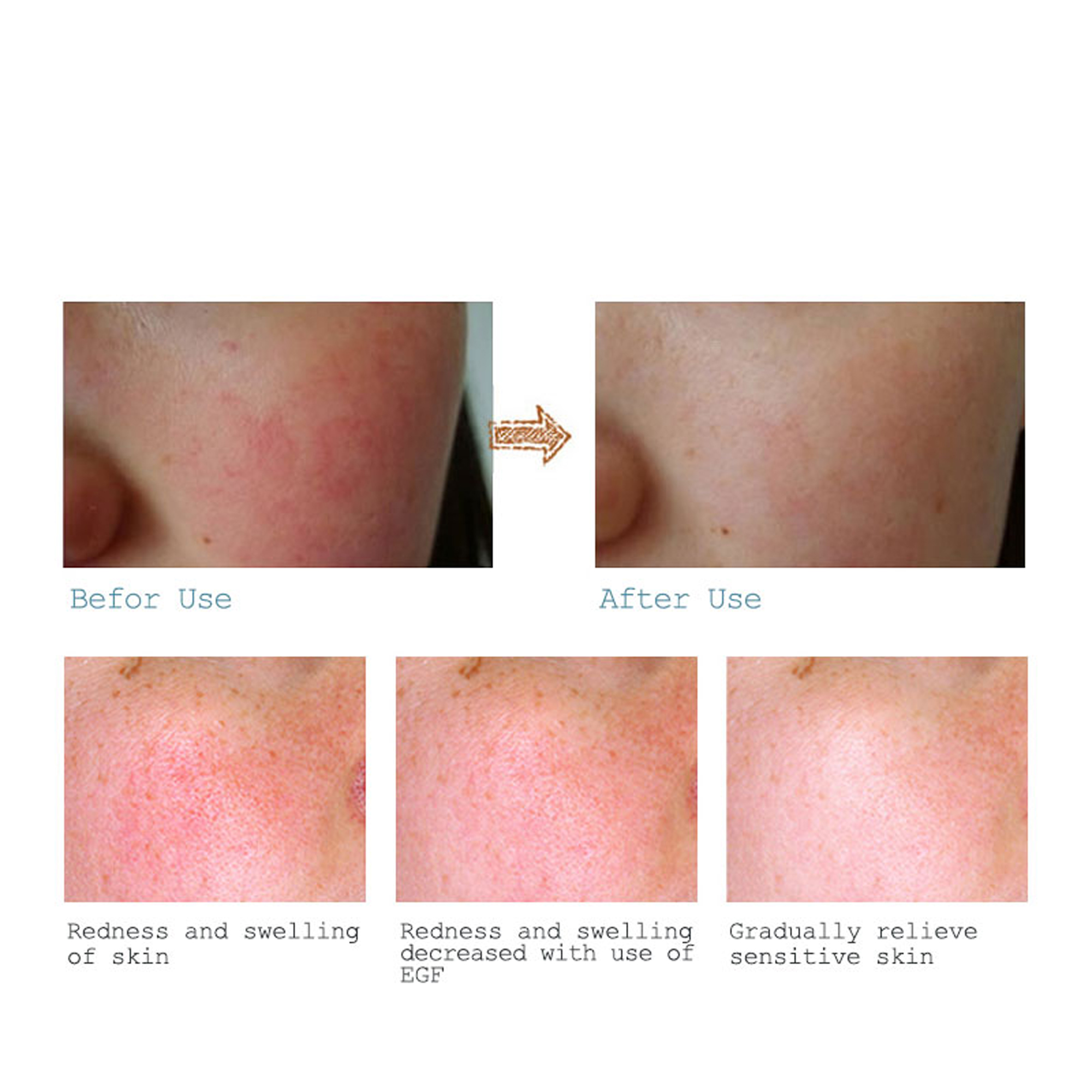 سيروم ماريا لعلاج آثار الحبوب والتجاعيد