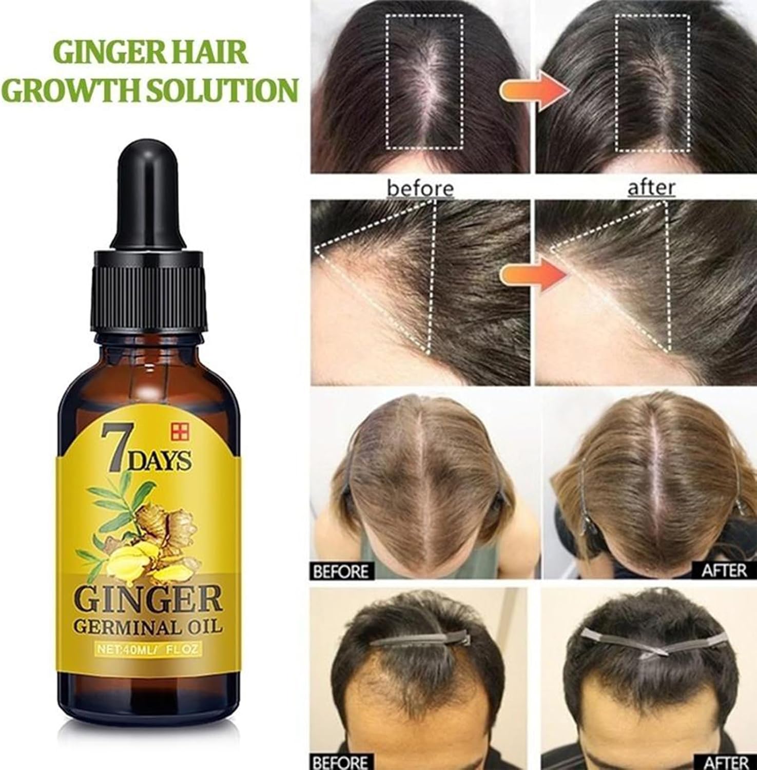 • المصل المعجزة لنمو الشعر في 7 أيام