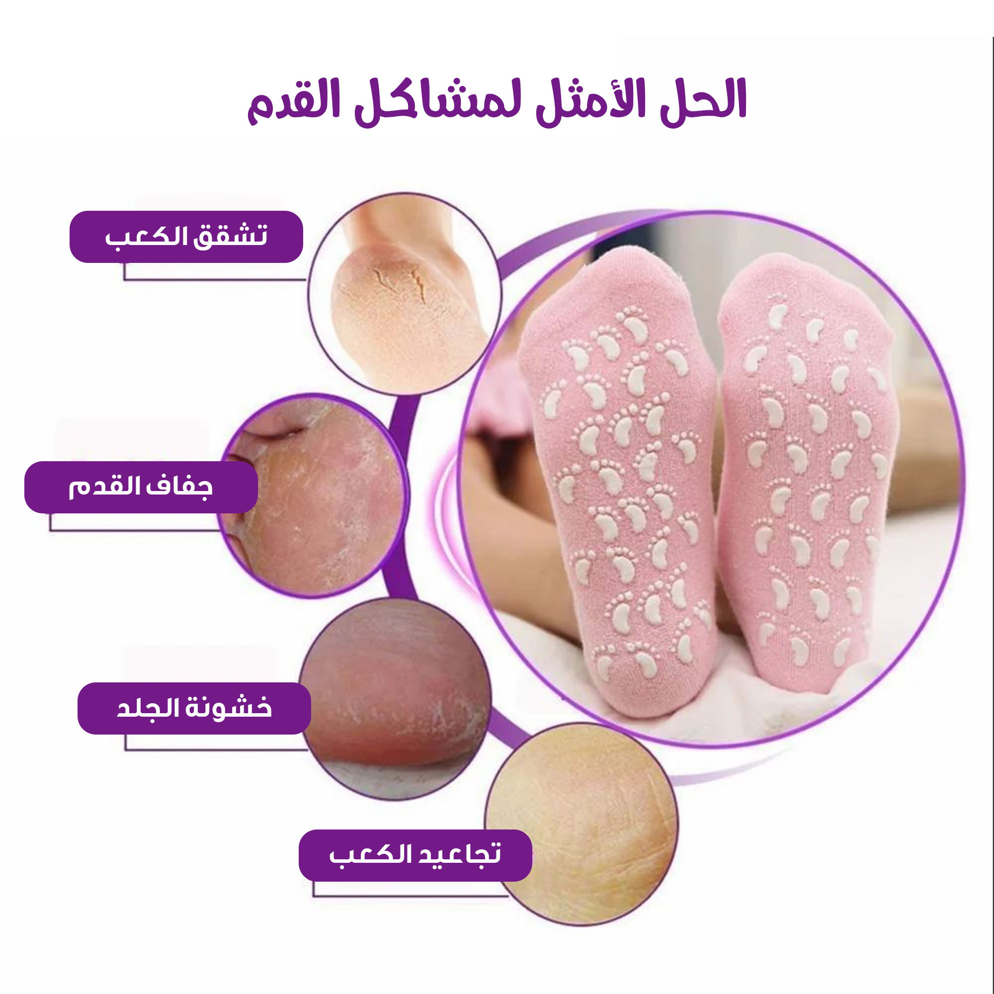 جوارب جيل لترطيب القدم