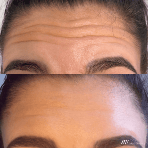✨ Gommes de peptides de collagène avec biotine, 60 unités– Effet tenseur immédiat pour une peau relâchée, améliore l’apparence jusqu’à 98% en 24h | Peau ferme + cheveux forts + ongles sains +