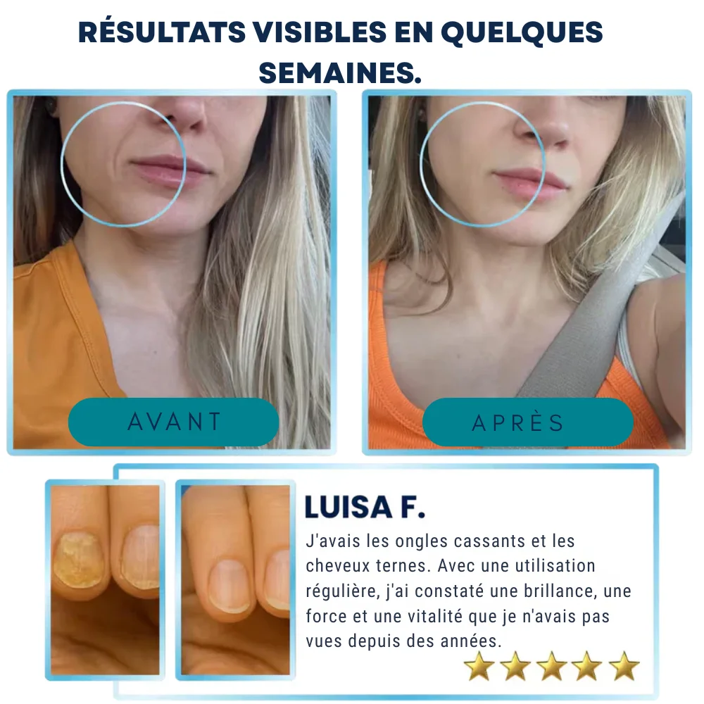 ✨ Gommes de peptides de collagène avec biotine, 60 unités– Effet tenseur immédiat pour une peau relâchée, améliore l’apparence jusqu’à 98% en 24h | Peau ferme + cheveux forts + ongles sains +