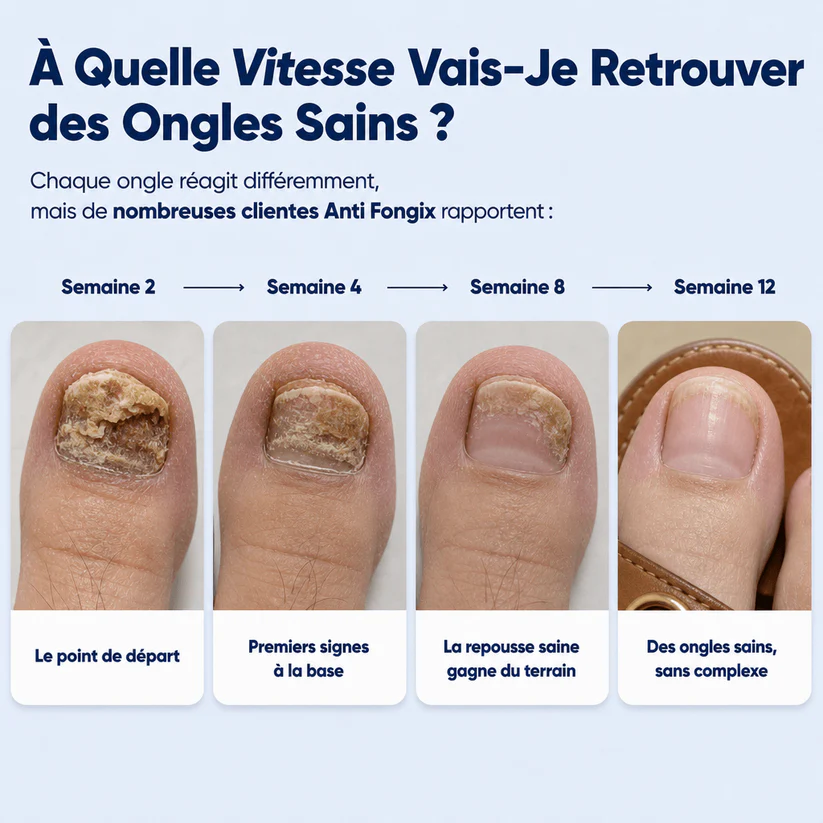 ✨ Collagène 5 en 1 – Des ongles plus forts, plus longs et moins cassants | Soutient la kératine de l'intérieur + cheveux brillants + peau éclatante + soutien des articulations ✨