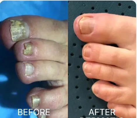✨ Collagène 5 en 1 – Des ongles plus forts, plus longs et moins cassants | Soutient la kératine de l'intérieur + cheveux brillants + peau éclatante + soutien des articulations ✨
